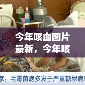 今年咳血圖片最新趨勢(shì)解析，你所不知道的信息全在這