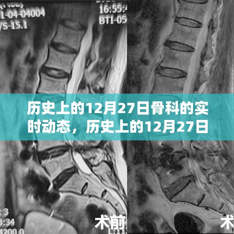 歷史上的骨科領(lǐng)域動態(tài)，聚焦十二月二十七日的實時進(jìn)展概覽