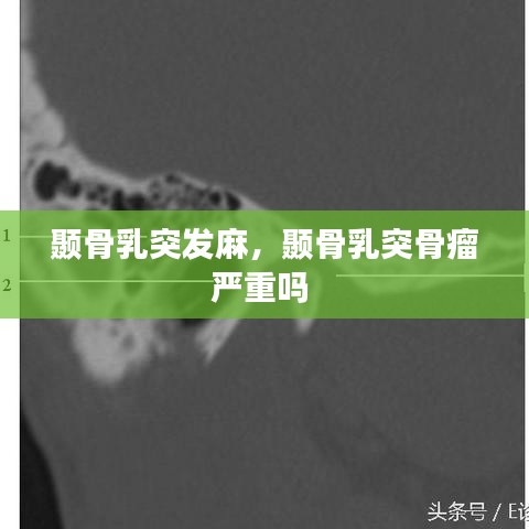 顳骨乳突發(fā)麻，顳骨乳突骨瘤嚴(yán)重嗎 