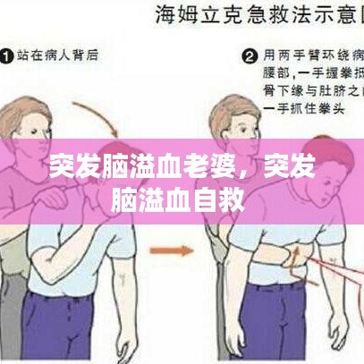突發(fā)腦溢血老婆，突發(fā)腦溢血自救 