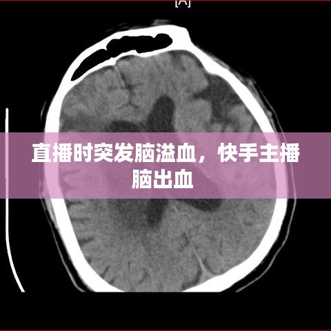 直播時(shí)突發(fā)腦溢血，快手主播腦出血 