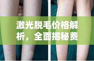 激光脫毛價(jià)格解析，全面揭秘費(fèi)用因素！