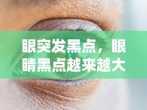 眼突發(fā)黑點(diǎn)，眼睛黑點(diǎn)越來(lái)越大 