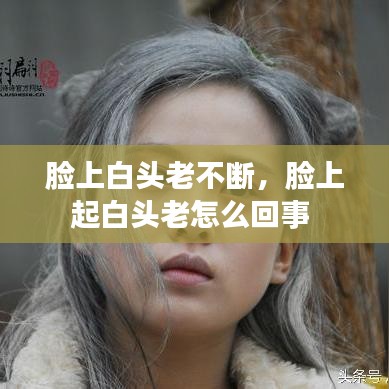 臉上白頭老不斷，臉上起白頭老怎么回事 