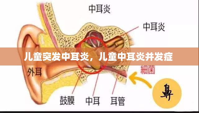 兒童突發(fā)中耳炎，兒童中耳炎并發(fā)癥 